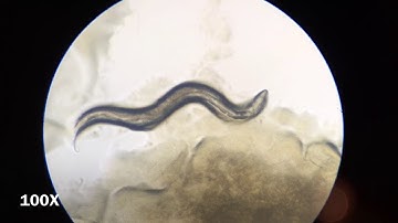 C. elegans Under the Microscope