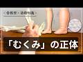 【むくみ（浮腫）】むくんでいる状態は「何が・どこに」溜まっているの？