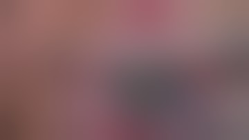 Novel No touch DSAEK technique by Steven Kane, MD and Eric Abdullayev, MD