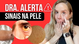 10 sinais na pele que revelam falta de vitaminas e doenças - Dra Bruna Scalco 10 sinais na pele que revelam falta de vitaminas e doenças - Dra Bruna Scalco