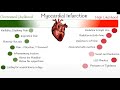 How to spot a heart attack? Acute Myocardial Infarction Signs and Symptoms.