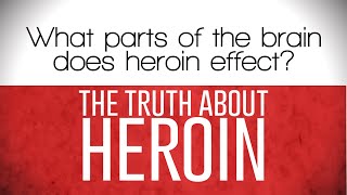 What parts of the brain does heroin affect? l The Truth About Heroin