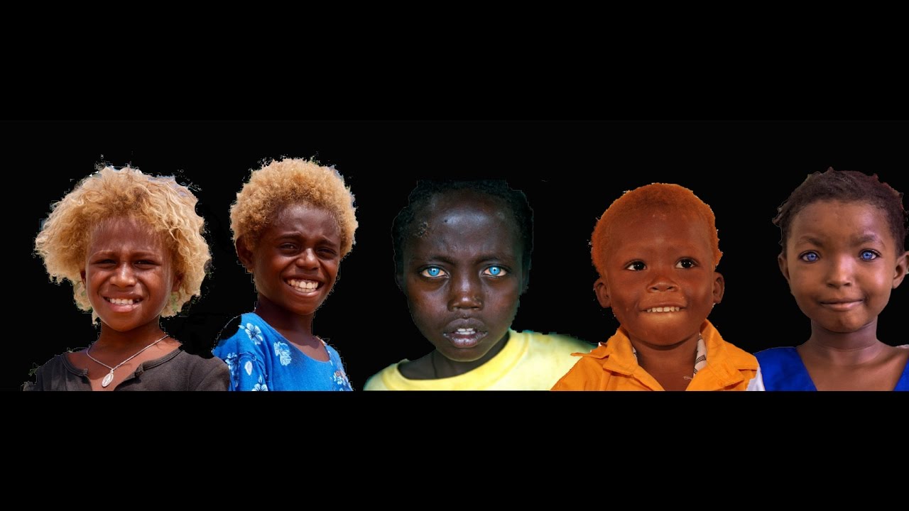 Black People With Natural Blonde Hair And Blue Eyes Collection