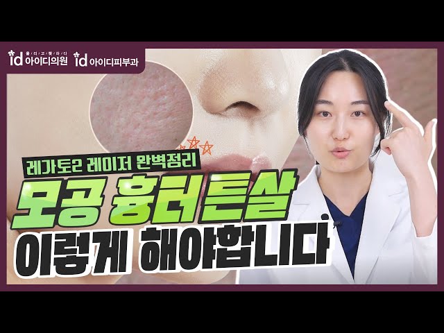 모공축소, 피부 흉터제거, 튼살에 최적화된 시술 (feat. 레가토2 레이저)