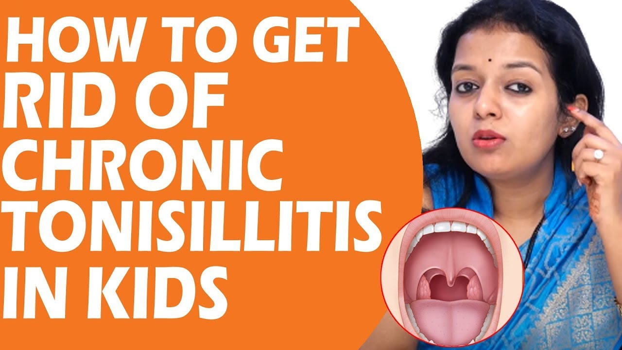 How To Get Rid Of Chronic Tonsillitis In Kids DR Lasya Sindhu
