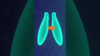 Targeted Therapy: Precision Medicine That Attacks Cancer's Weak Points