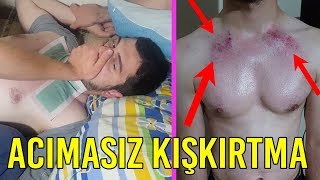 Uykudan Uyandirip Ağda Yapmak - Kişkirtma Şi̇kayet Etti̇ler