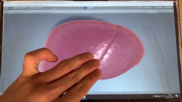 3DoF Movable Touch Screen (Liver)