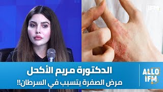 د. مريم الاكحل : مرض الصفرة موش معدي لكن ينجم يكون مخطر وهذه أهم أعراضو