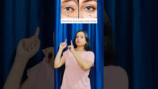 Reduce Eye Bags Naturally 👁️✨#eyebags #eyepuffiness #faceyoga #yogaforeyes #shortsviral