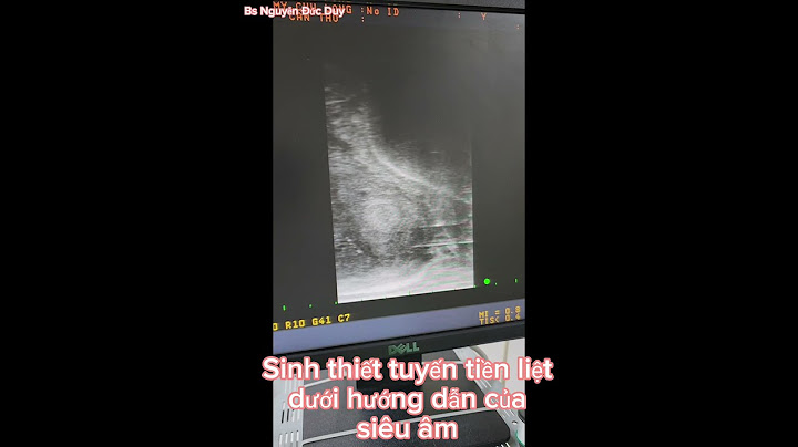 Hướng dẫn siêu âm tiền liệt tuyến