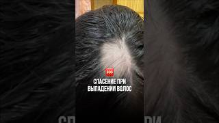 ЭТА МАСКА СПАСЛА МЕНЯ ОТ ОБЛЫСЕНИЯ 🫣#уходзаволосами #маскадляволос #выпадениеволос #выпадение