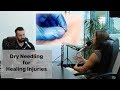 Dry Needling Benefits for Pain | How Does Dry Needling Work? ft. Dr. Jessica Warnecke