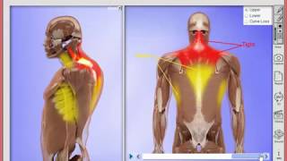 Explain Posture Using Virtual Consultation 3D Software