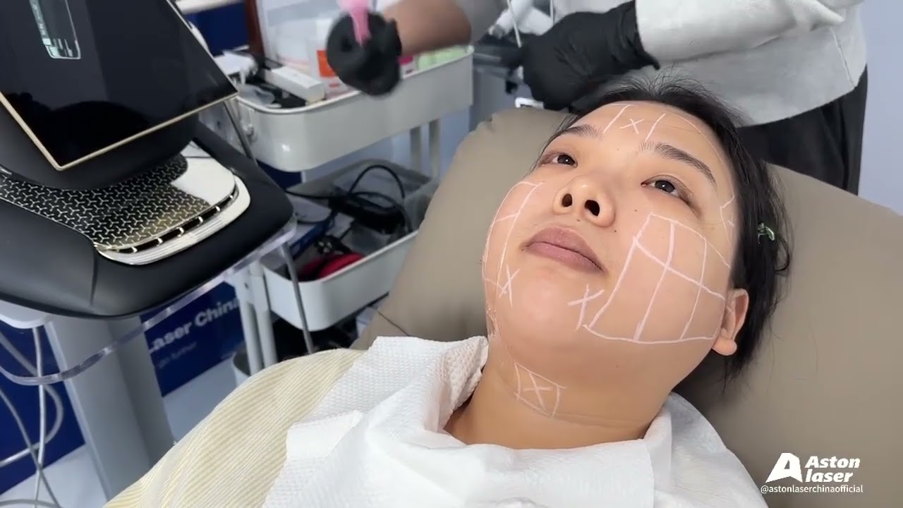 HIFU HF09 Training Video | Professional Operation Guide