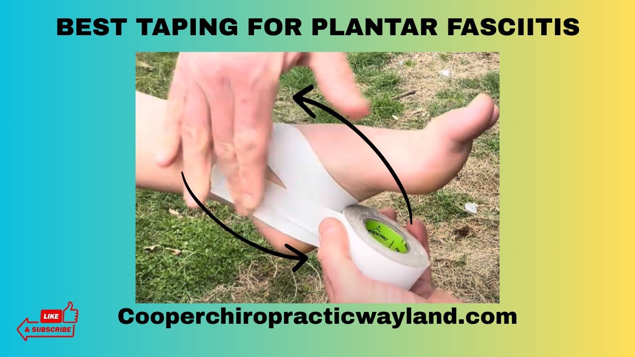 Best Taping for Plantar Fasciitis