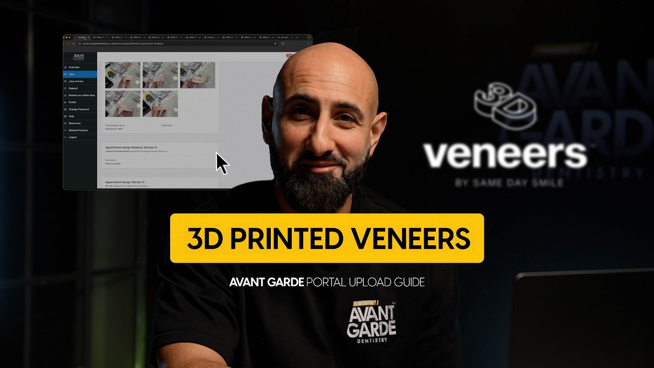 3D Veneers - Avant Garde Portal Tutorial