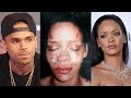 Chris Brown Describes the Rihanna FIGHT in His New Documentary Welcome To My Life