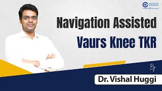 Navigation Assisted Vaurs Knee TKR By Dr. Vishal | Orthopedic Residency | Conceptual Orthopedic screenshot 4