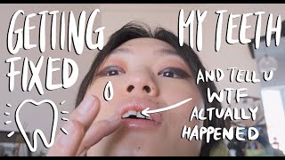 why my teeth are crooked + cooking while my mental health was not doing great