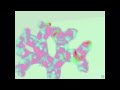 FractAléa Solo 2021 Arbre de Pythagore Thierry Bettosini TB Trope (audio-vidéo)