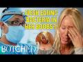 Flesh Eating Bacteria Rotted Away Heather S Boobs And Acting Career Before After Botched E 