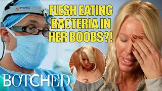 Flesh Eating Bacteria Rotted Away Heather's Boobs and Acting Career (Before & After) | Botched | E!
