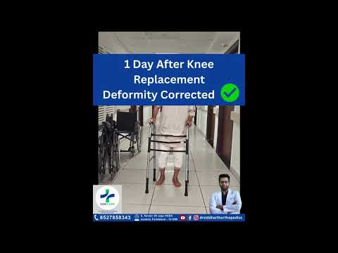 Knee Strengthening After Replacement Surgery — video by Dr. Siddharth Gupta, orthopaedic surgeon, Faridabad