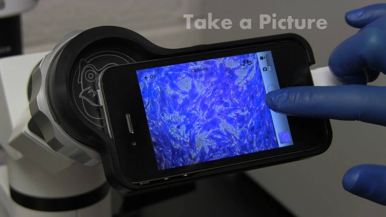 ScopeMonkey Turns an iPhone into a Camera for Microscopes, Telescopes