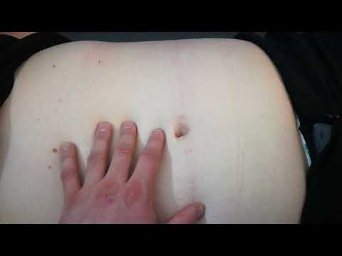 შემთხვევა როდესაც პაციენტს ბევრი რამ აწუხებს