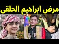 عاجل شاهد بالفيديو حقيقة مرض ابراهيم الحلقي الطفل السوري الشيخ ولماذا اخفاه عن الجميع سيصدمكم 