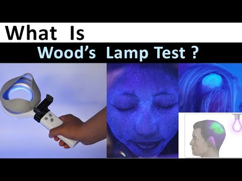 Video: Wood's Lamp Examination: Syfte, Förfarande Och Resultat