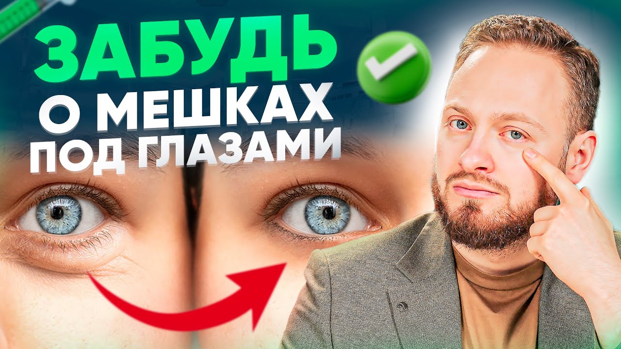 Как убрать малярные мешки и грыжи под глазами? (видео без воды) - YouTube