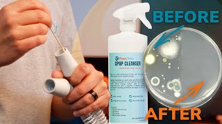 You Won't Believe The GERMS On Your CPAP Equipment 🤢