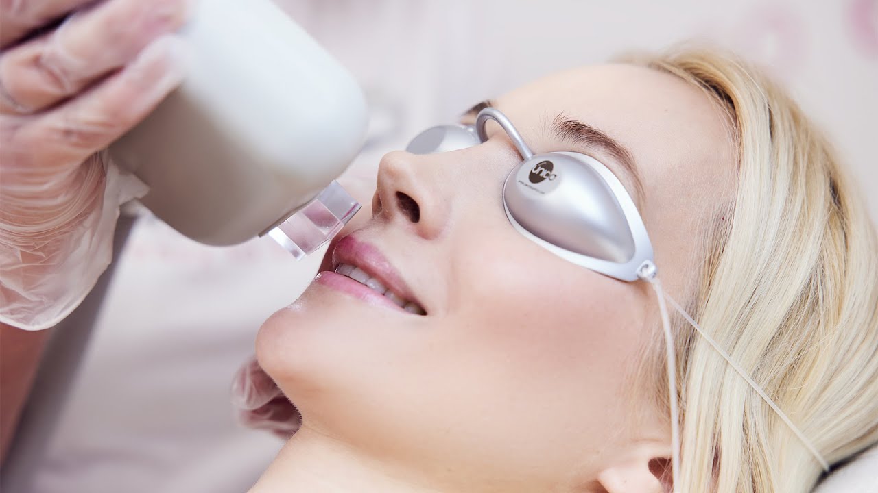 Dauerhafte Haarentfernung made by hairfree Gesicht