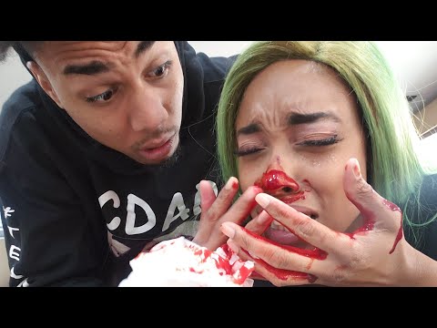 EXTREME BROKEN NOSE PRANK ON BF!!! BLOODY!!!
