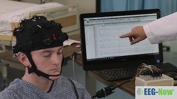 EEG-Now Instant Recovery of Movement Artifacts