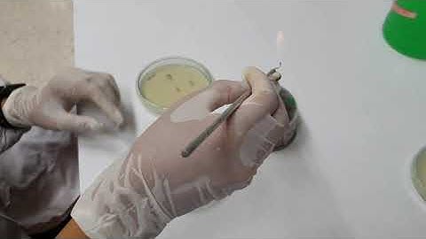 Mycology Lab Practical 2: Transferring of Fungal Cultures