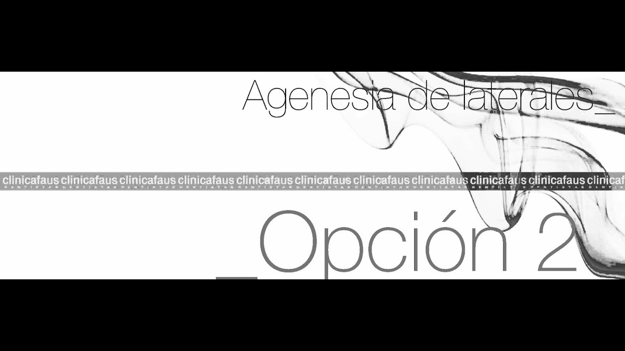 agenesia incisiva tratamiento lateral superior agenesia incisiva tratamiento lateral superior