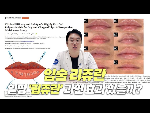[논문 리뷰] 요즘 핫한 시술 '립쥬란' 과연 효과는 어떨까?
