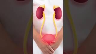 Uterine Fibroids Explained: Symptoms vs Complications# UterineFibroids #HeavyPeriods #Anemia