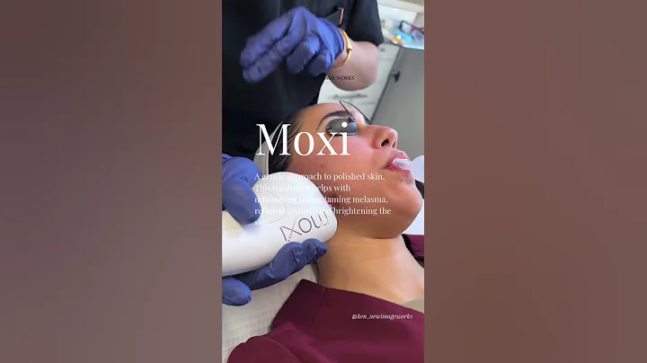 MOXI Laser Treatment for Radiant Skin ✨ | Gentle & Effective for All Skin Types