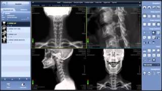Details Xmaru Chiropractic Viewer News