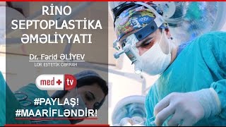 Rinoseptoplastika (burun plastik emeliyyati) - Dr. FARID ALIYEV LOR Estetik CERRAH MEDPLUS TV