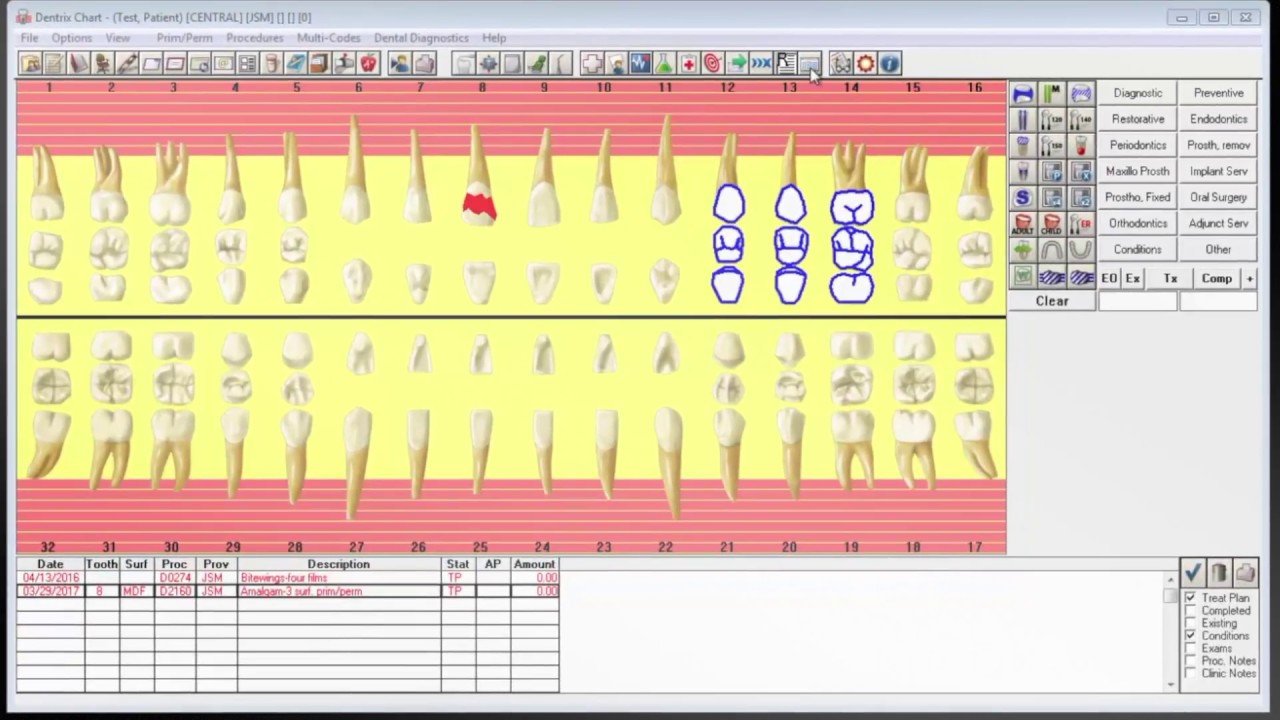 Dentrix Tooth Chart