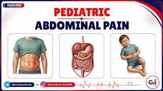 48. Pediatric Abdominal Pain: Appendicitis vs Intussusception vs Constipation Explained