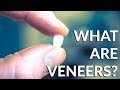 DENTAL VENEERS - WHAT THE HECK ARE THEY? (COSMETIC DENTISTRY)