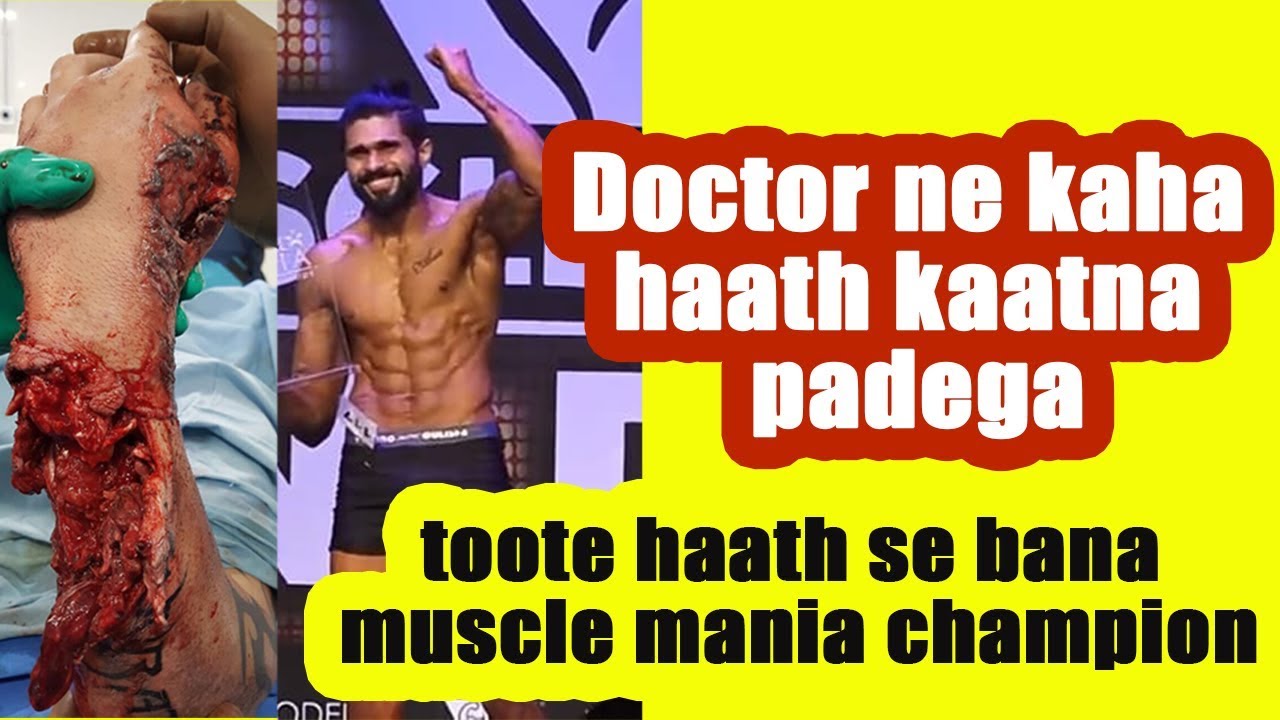 Doctor ne kaha haath kaatna padega | Kate haath mein bana champion on Tarun Gill Talks Doctor ne kaha haath kaatna padega | Kate haath mein bana champion on Tarun Gill Talks