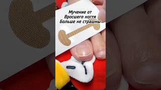 Мучения от вросшего ногтя больше не страшны #wildberries