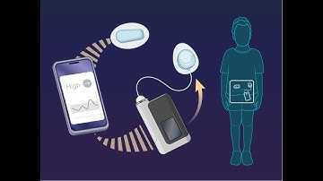 Closed-Loop Therapy in Very Young Children with Type 1 Diabetes | NEJM